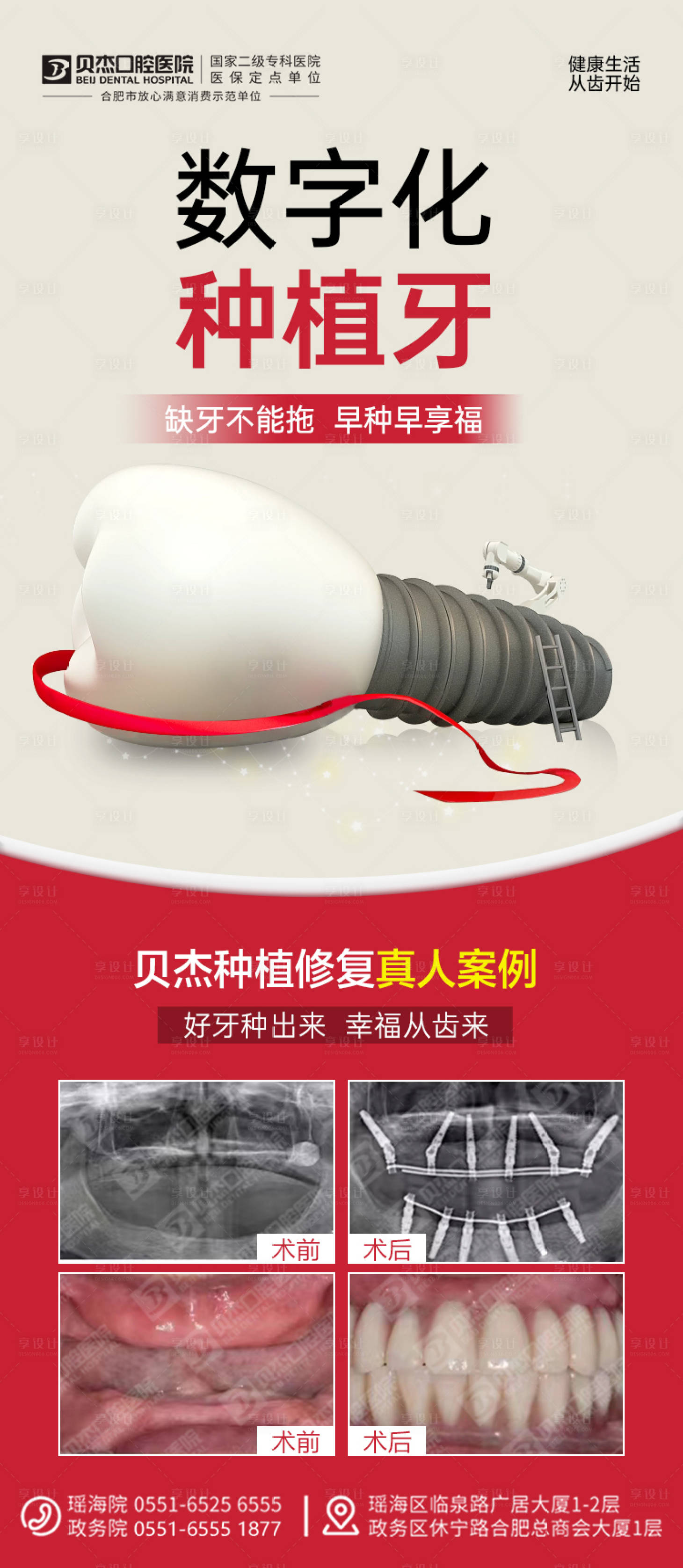 源文件下载【种植牙海报】编号：82840013508273464