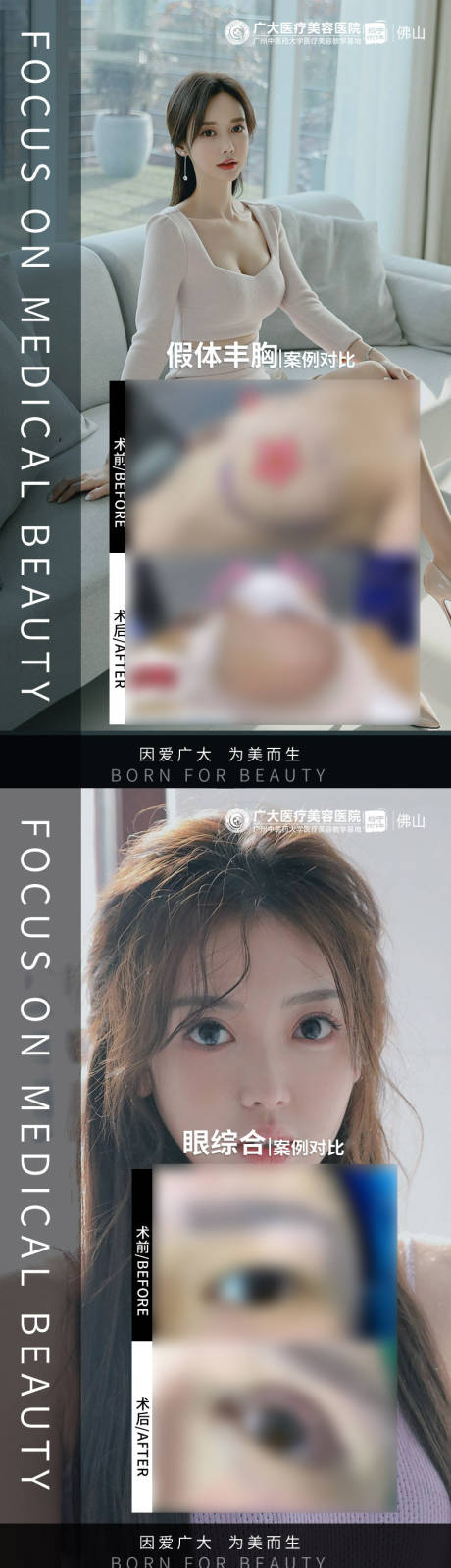 源文件下載【享設計】搜索編號：31570009283836375【整形眼鼻胸真人案例分享集】