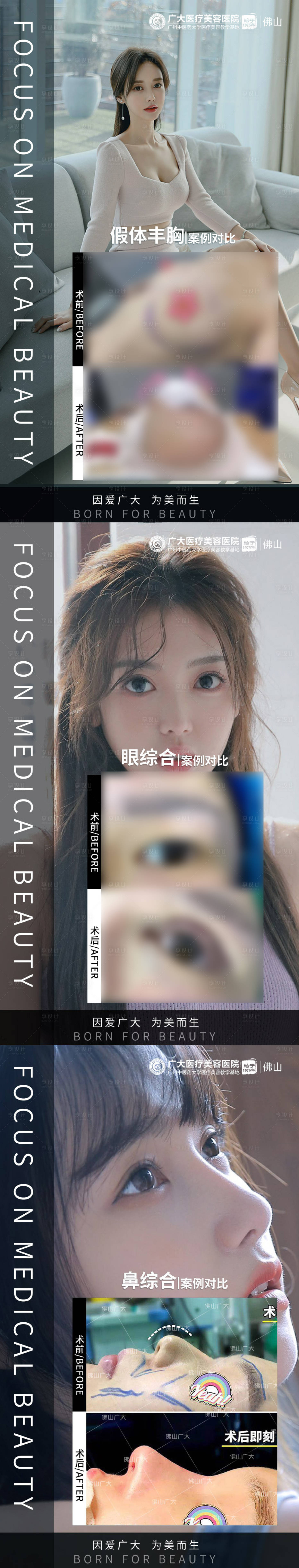 源文件下載【享設計】搜索編號：31570009283836375【整形眼鼻胸真人案例分享集】