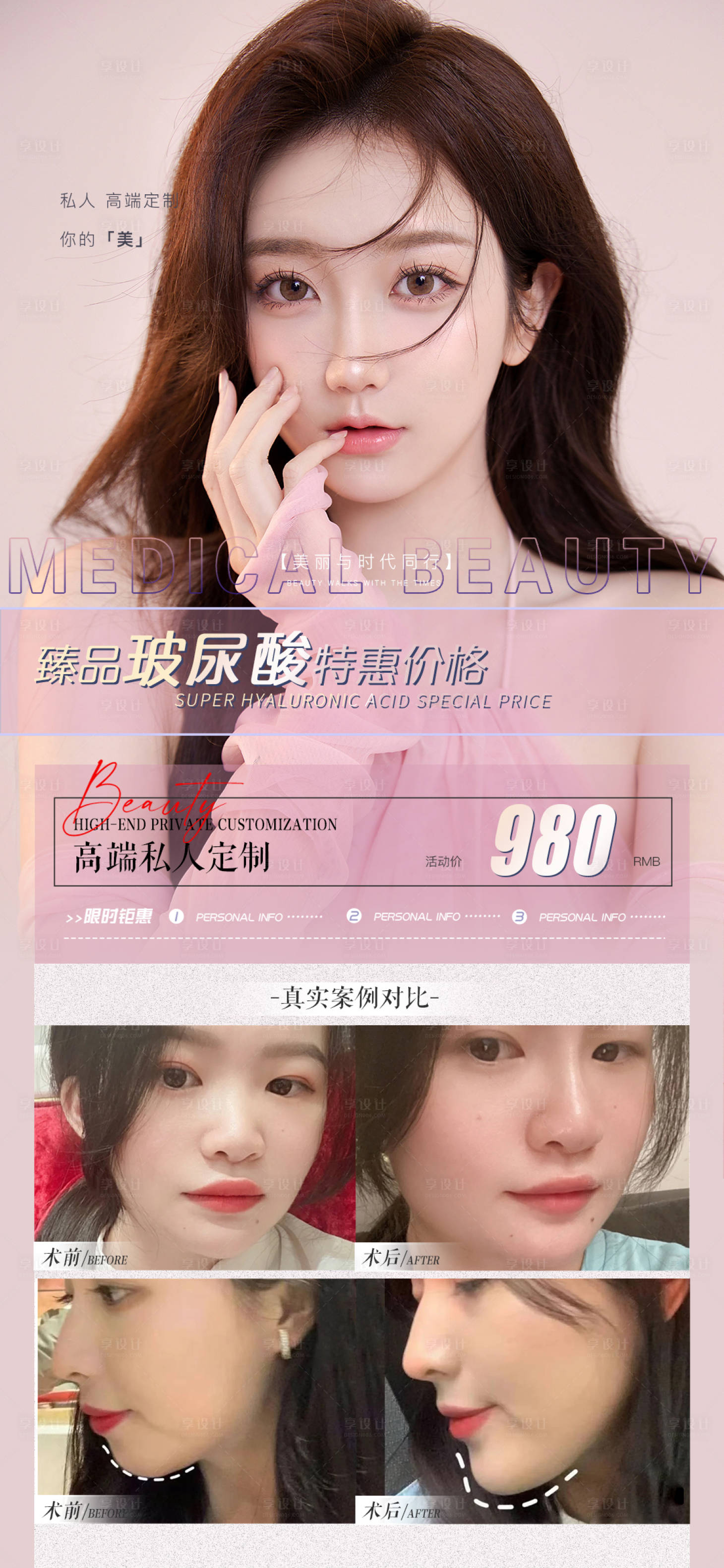 源文件下载【医美玻尿酸注射海报】编号：16650013489323177