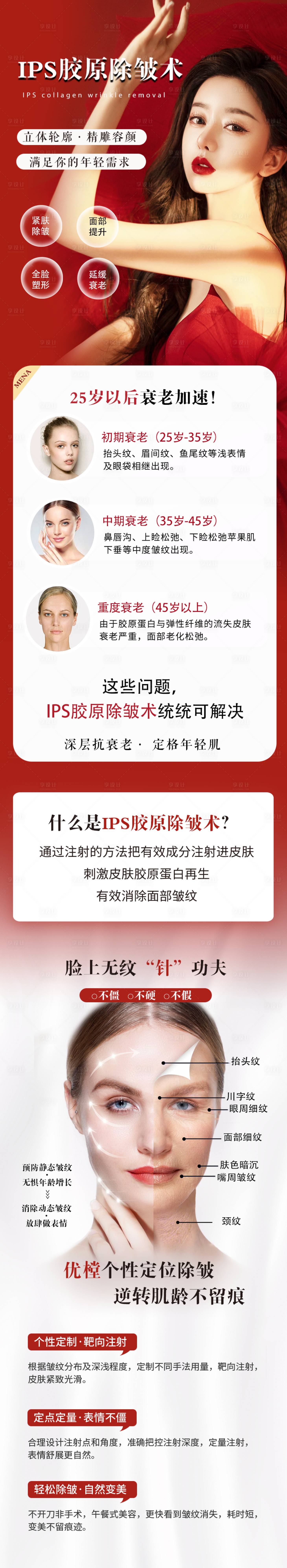 源文件下载【IPS胶原除皱术详情页】编号：80560013104604581