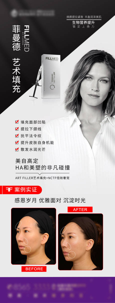 源文件下载【费曼德案例海报】编号：33820013420284911