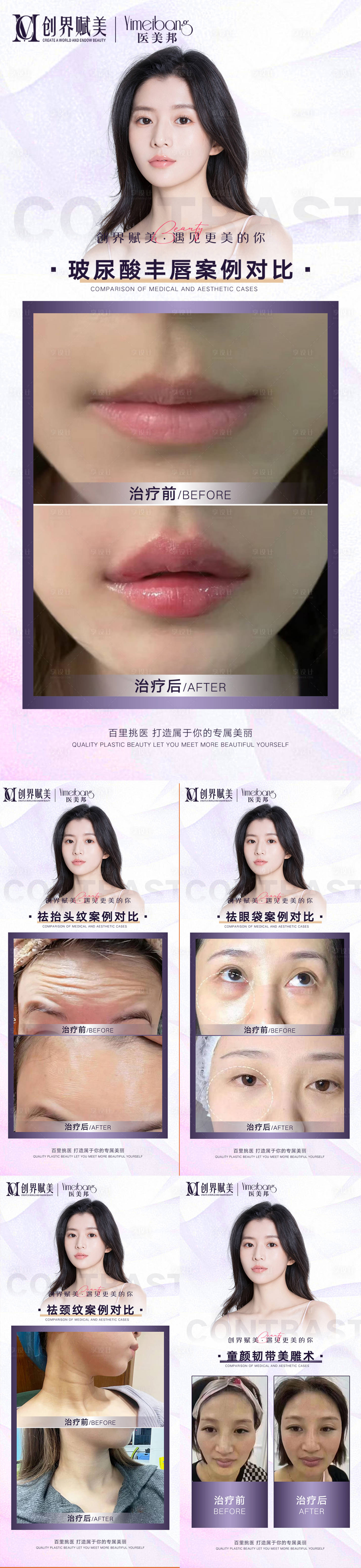 源文件下載【享設計】搜索編號：14530013601906399【醫美加推案例對比系列海報】