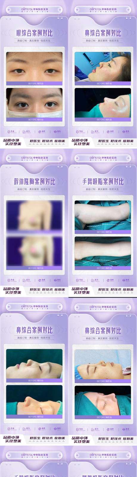 源文件下载【医美整形案例对比】编号：62400013226094850