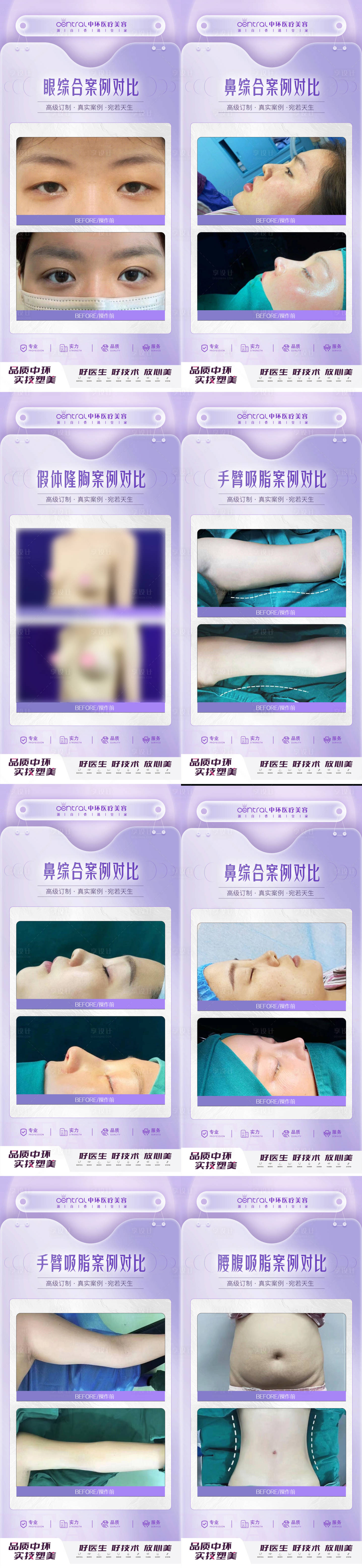 源文件下载【享设计】搜索编号：62400013226094850【医美整形案例对比】