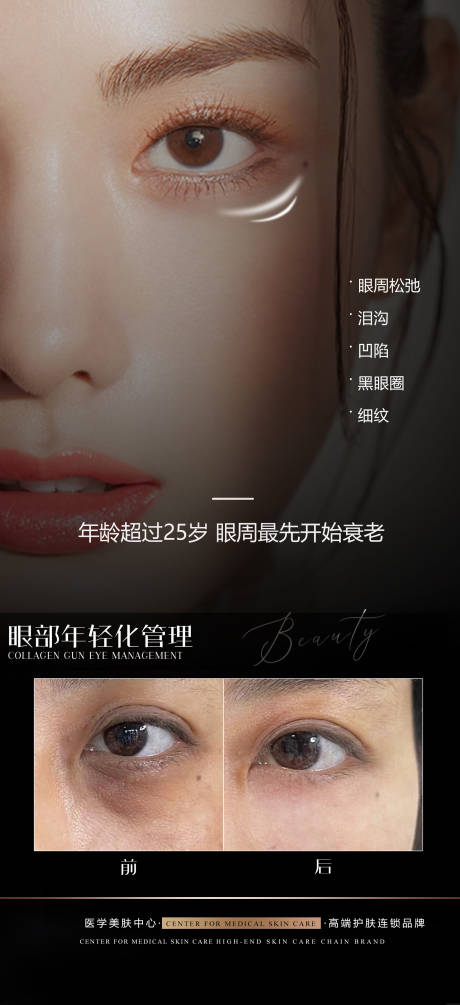 源文件下载【享设计】搜索编号：35160013107881532【医美眼部抗衰宣传海报】