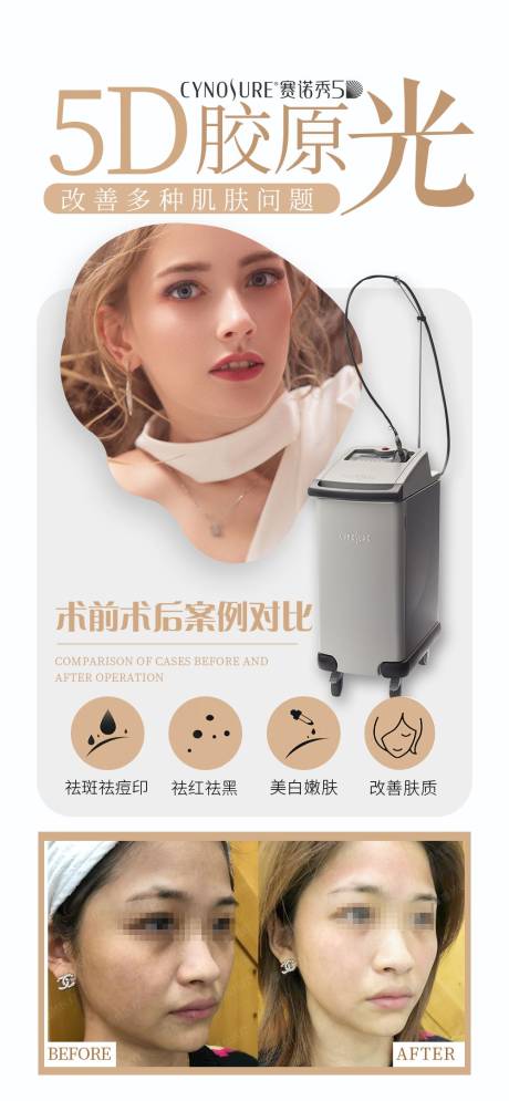 源文件下載【醫(yī)美案例對比海報】編號：71360013469174645