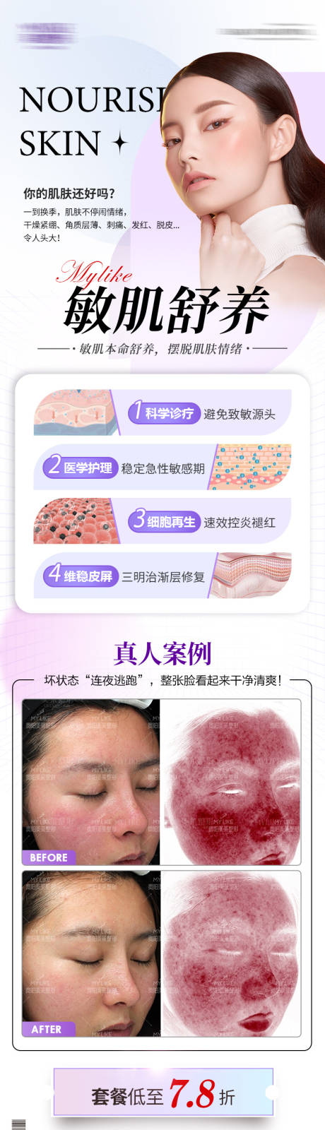 源文件下载【皮肤敏感肌产品海报】编号：67340013957793852