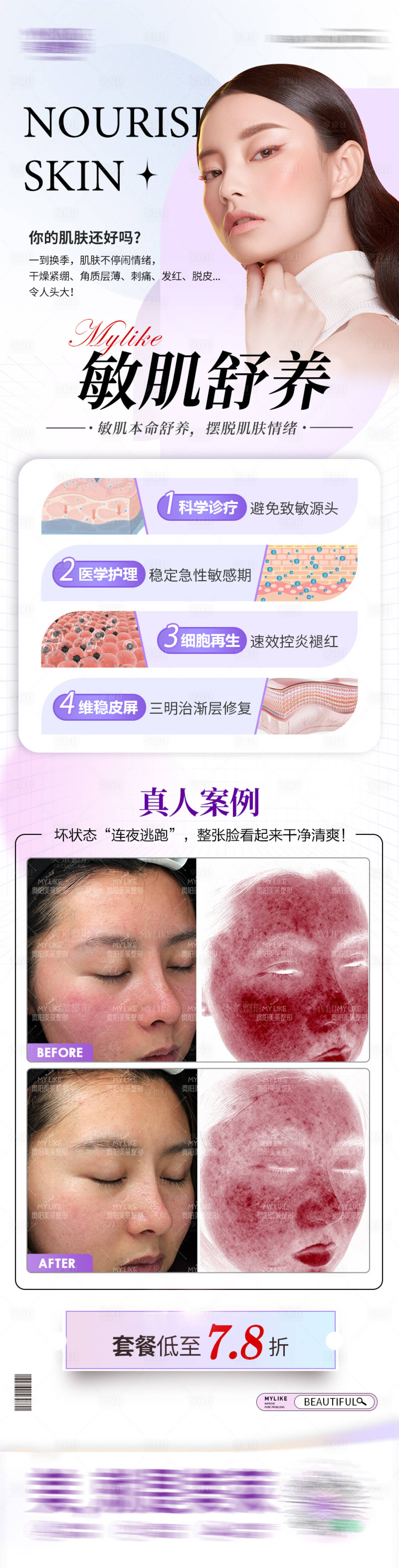 源文件下载【享设计】搜索编号：67340013957793852【皮肤敏感肌产品海报】