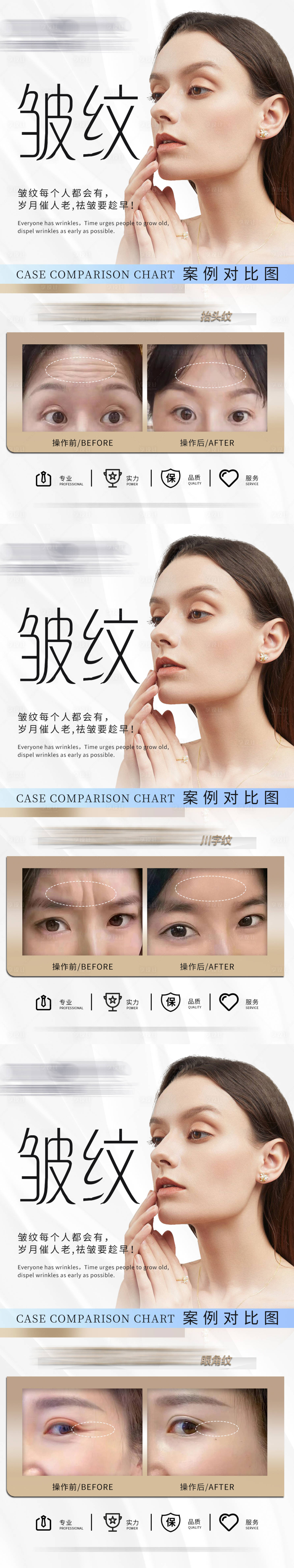 源文件下載【享設(shè)計(jì)】搜索編號：98350013874908769【 醫(yī)美祛皺案例對比圖海報(bào)】