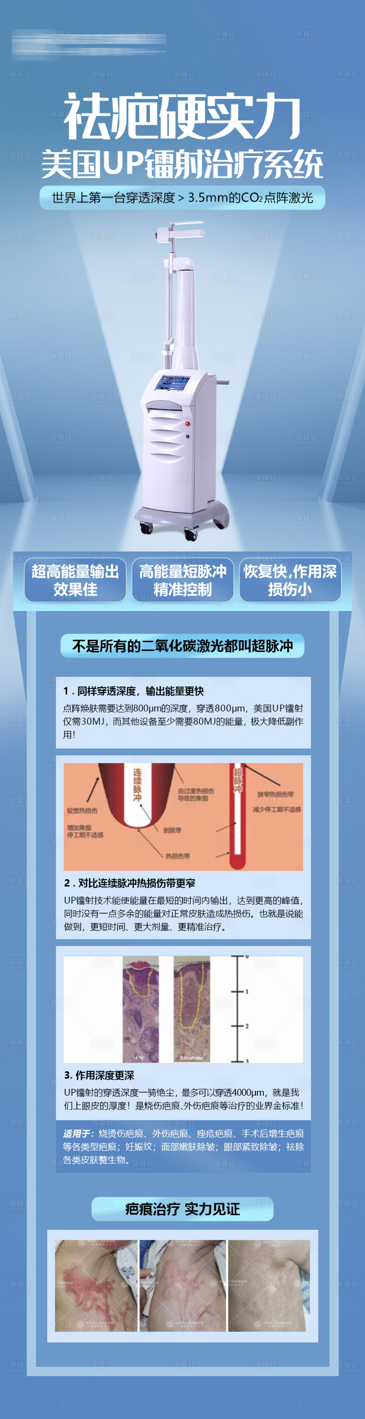 源文件下载【享设计】搜索编号：27740014047368236【医美整形美容祛疤仪器海报长图】