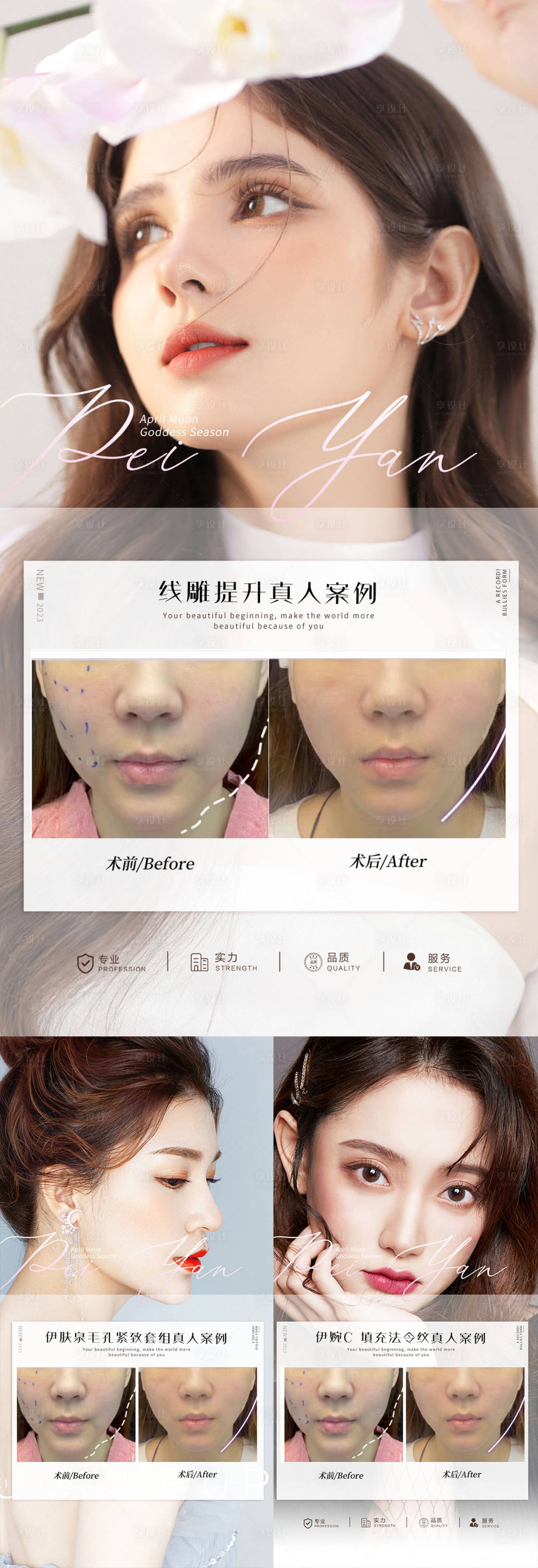 源文件下载【享设计】搜索编号：63130013787016107【案例对比】