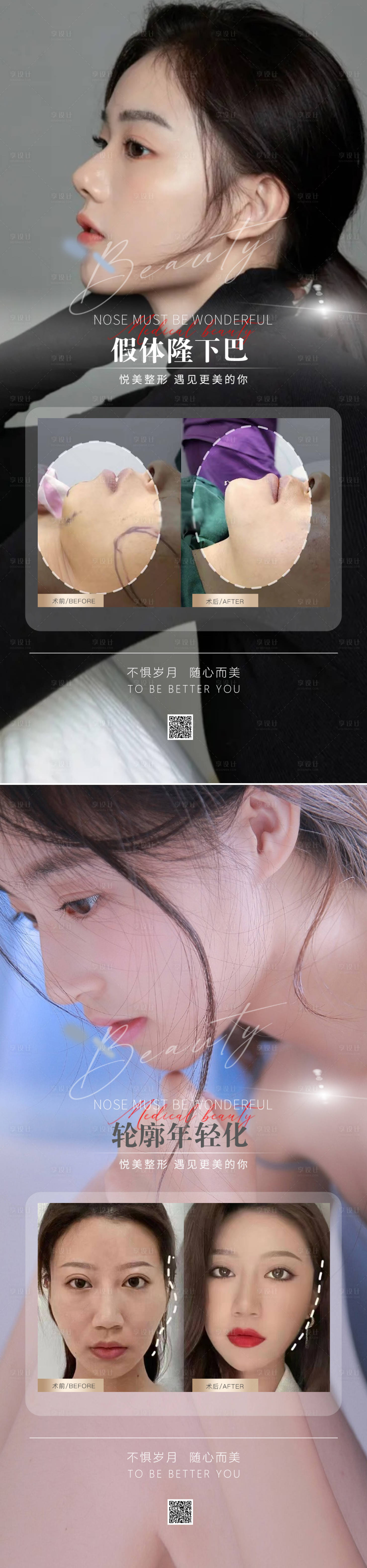 源文件下载【享设计】搜索编号：65120013713619791【医美隆鼻案例对比图】