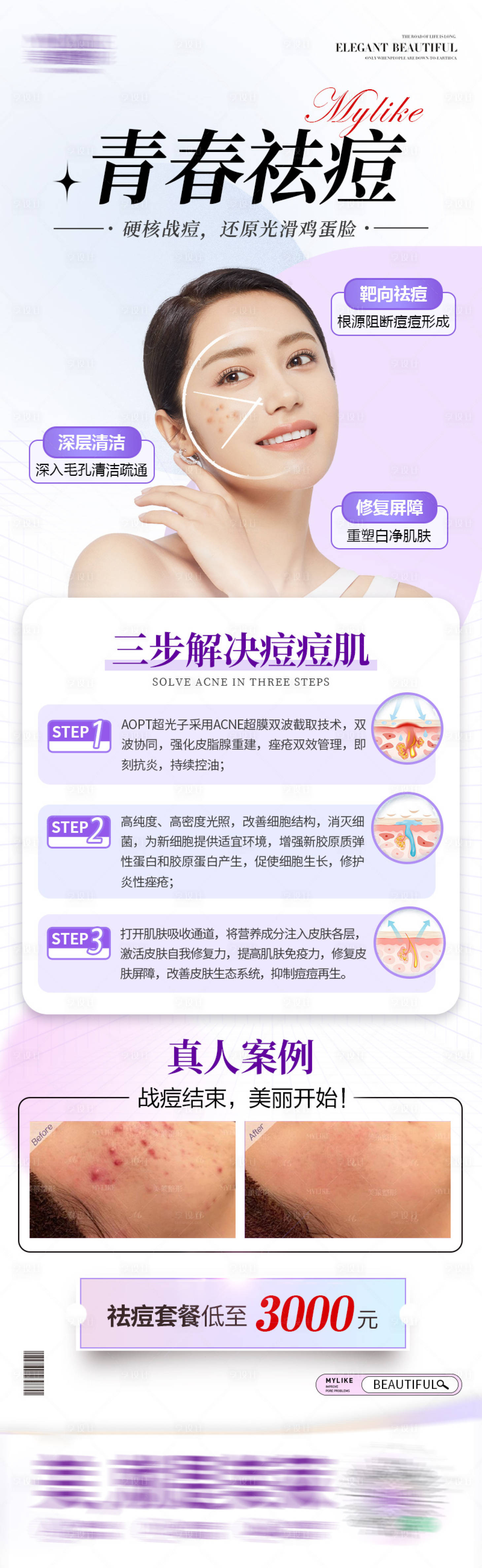 源文件下載【享設(shè)計(jì)】搜索編號(hào)：27600013957975301【皮膚祛痘產(chǎn)品長(zhǎng)圖】
