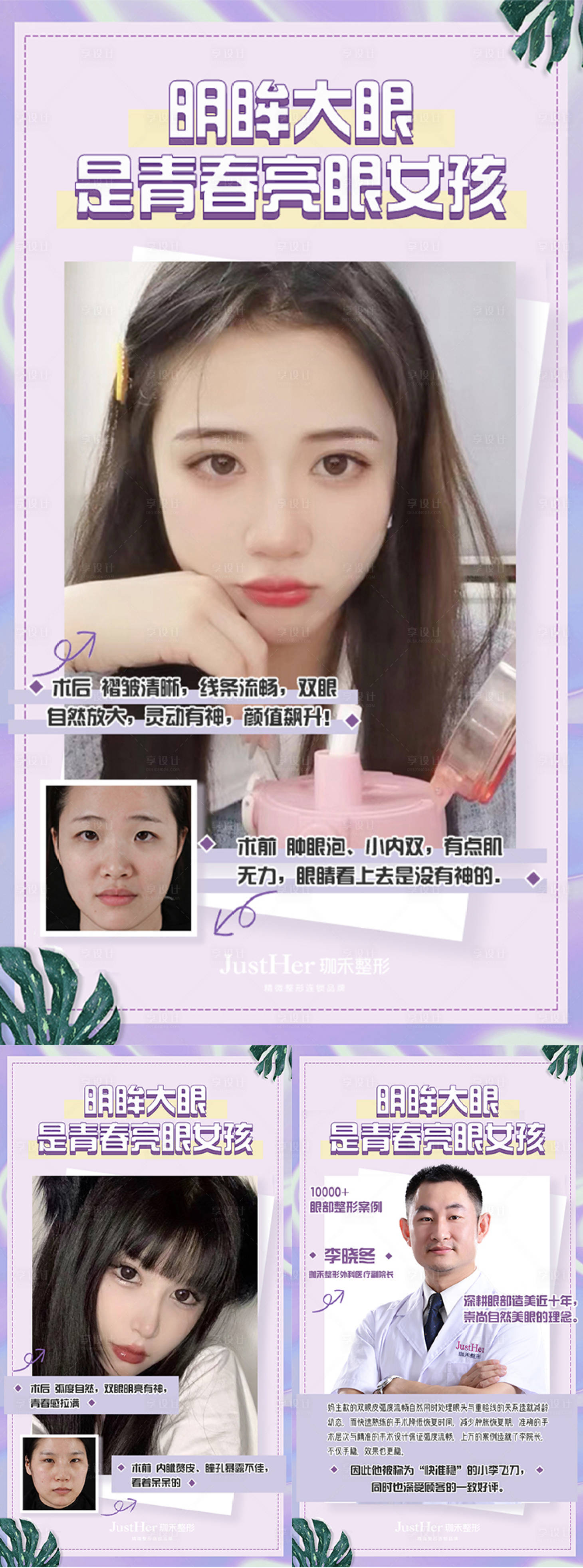 源文件下载【幼态眼案例系列】编号：98990013709386289