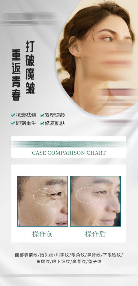 源文件下载【除皱海报案例对比图】编号：22630014025777698