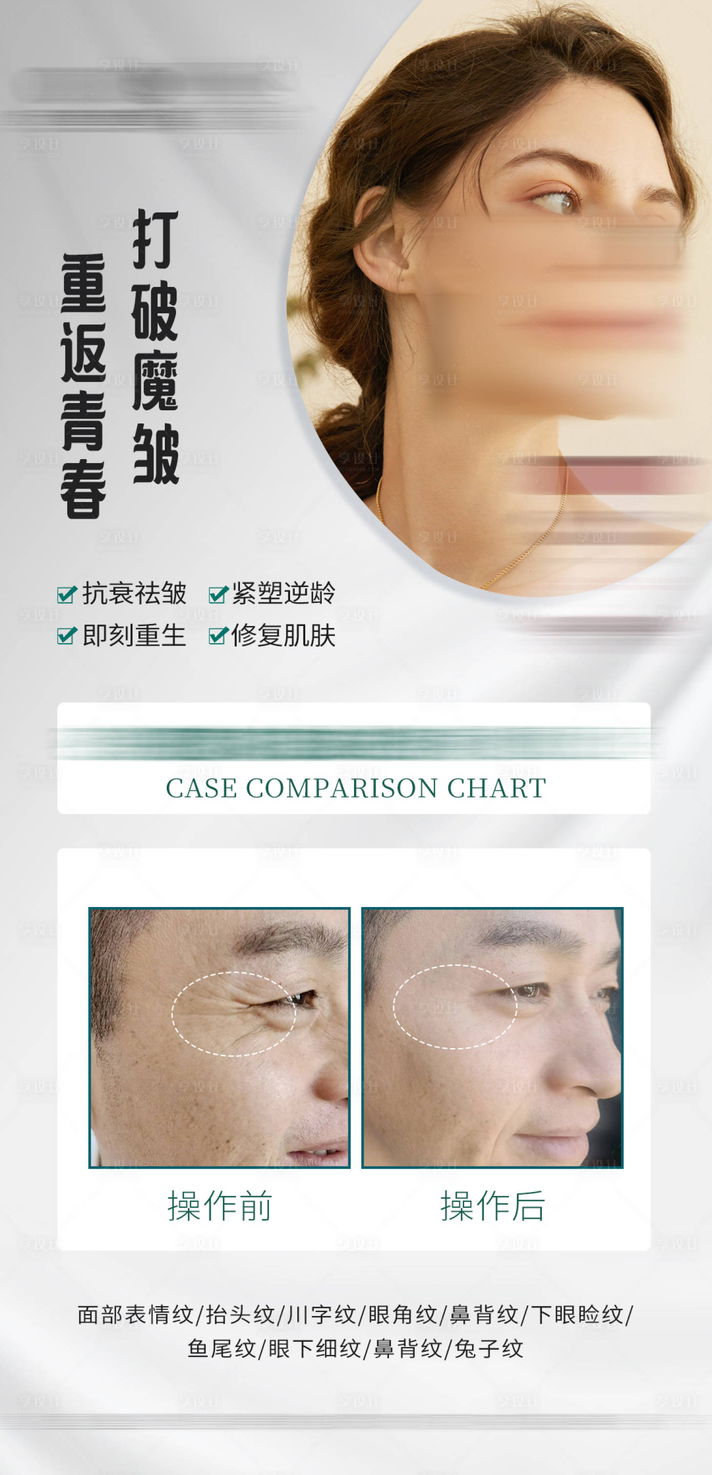源文件下载【享设计】搜索编号：22630014025777698【除皱海报案例对比图】
