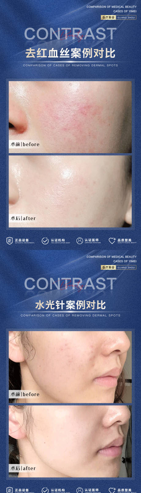 源文件下載【享設計】搜索編號：42120013863312120【醫美案例術后對比海報】