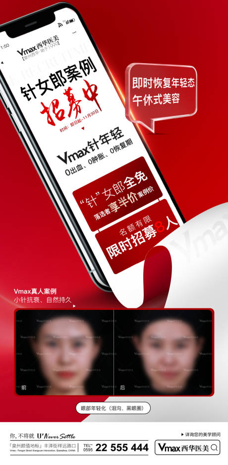 源文件下载【少女针招募海报】编号：75760013812444968