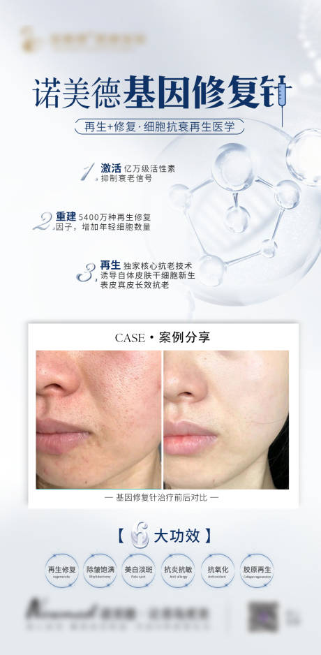 源文件下载【医美海报】编号：46180014062445868