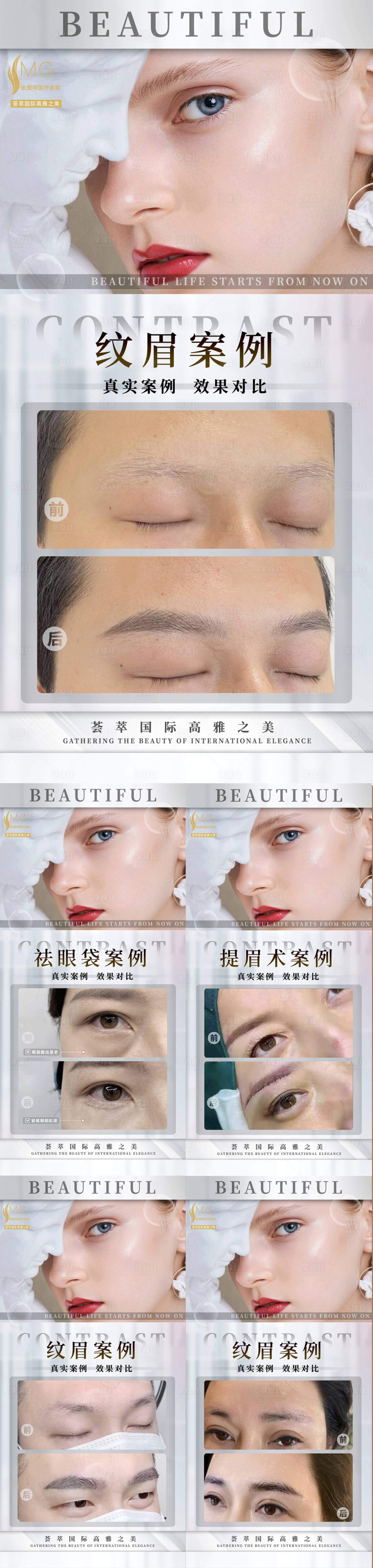 源文件下載【享設計】搜索編號：30850014023978628【醫(yī)美紋眉祛眼袋案例】