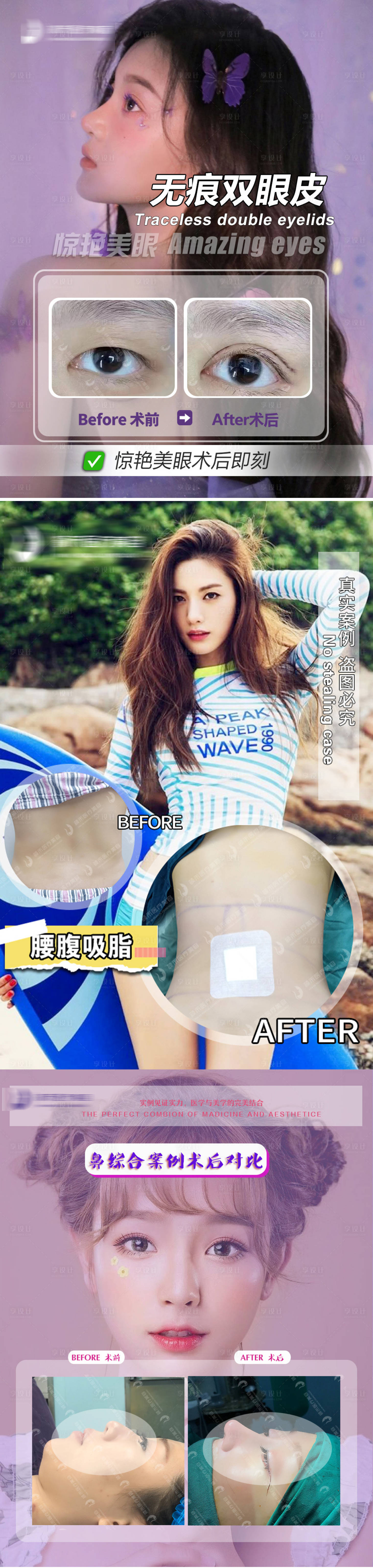 源文件下载【轻奢医美案例海报】编号：49610013815471944