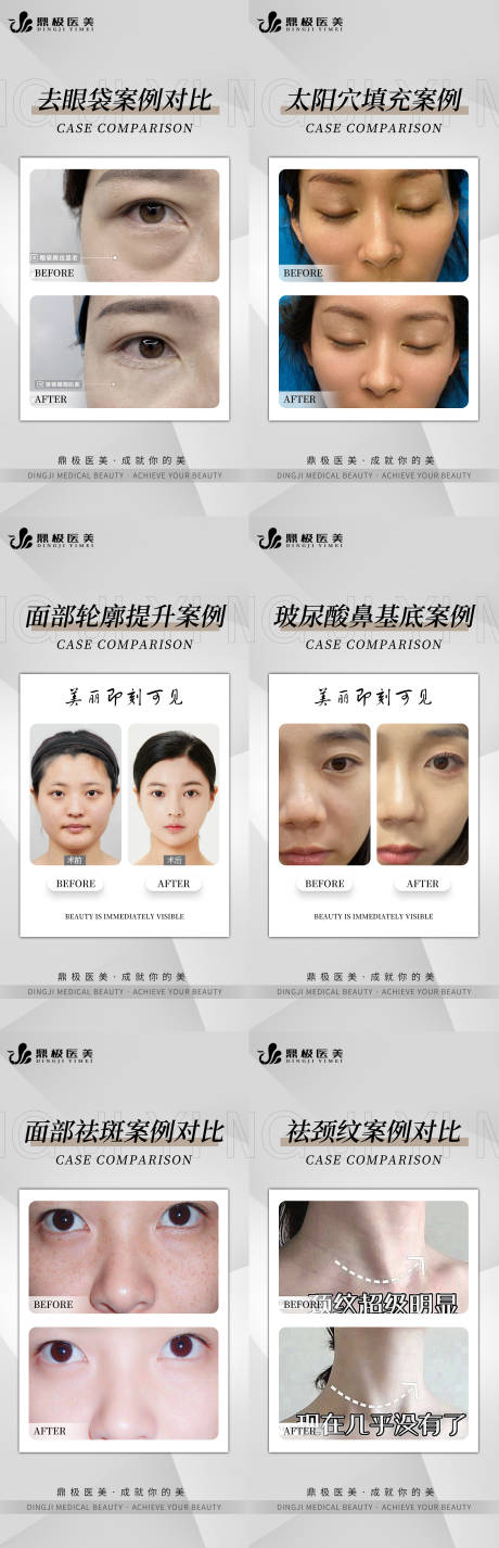 源文件下载【医美案例对比6组】编号：73580013988678438