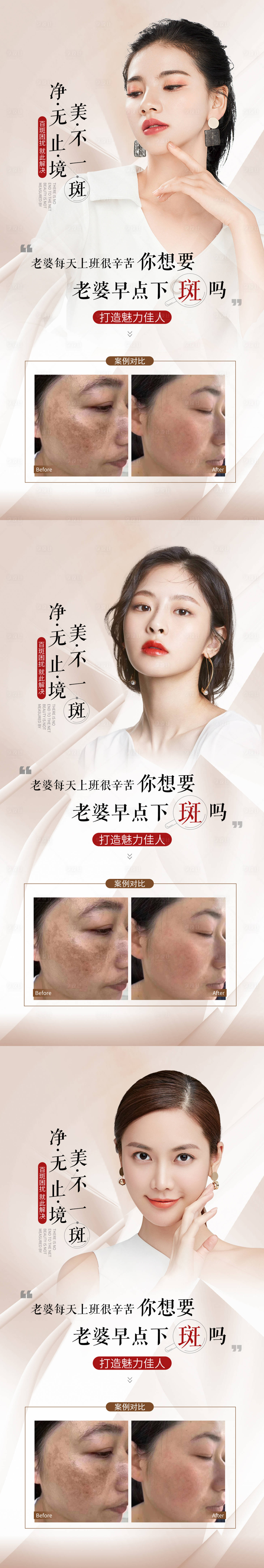 源文件下载【享设计】搜索编号：45530013639307147【祛斑海报促销】