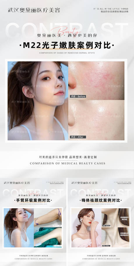 源文件下载【医美整形案例对比】编号：15350013647075100