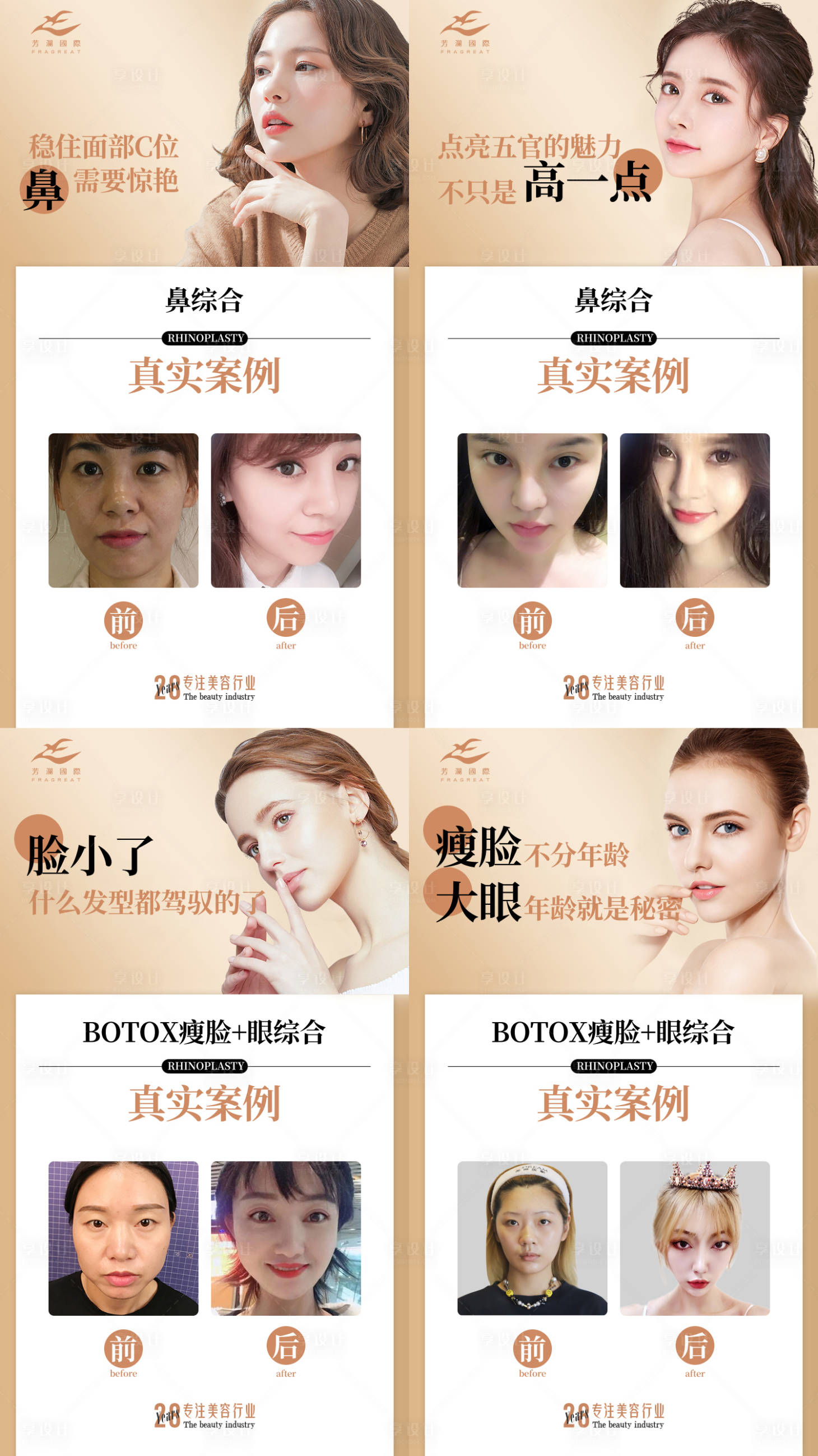 源文件下載【享設計】搜索編號：32040013765186221【醫美對比案例 】