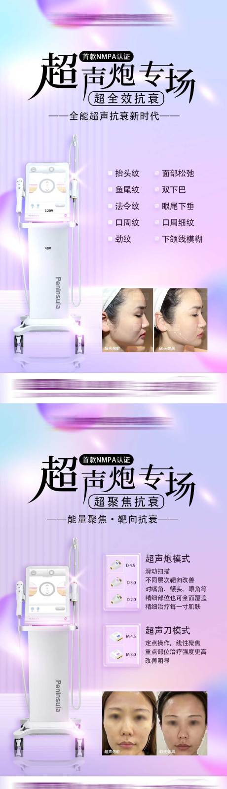 源文件下载【超声炮系列】编号：95070014051098281