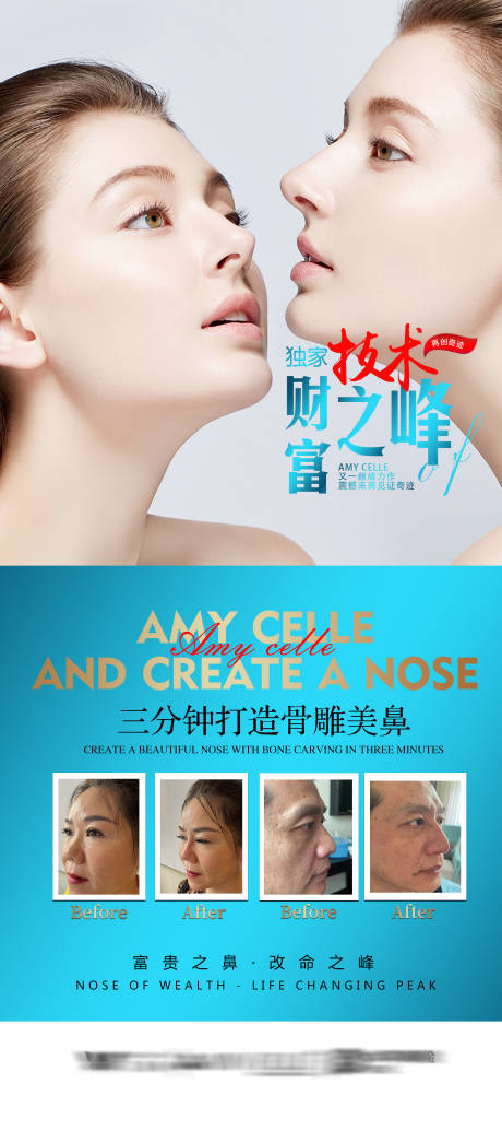 源文件下载【医美隆鼻展架】编号：56930013635231957