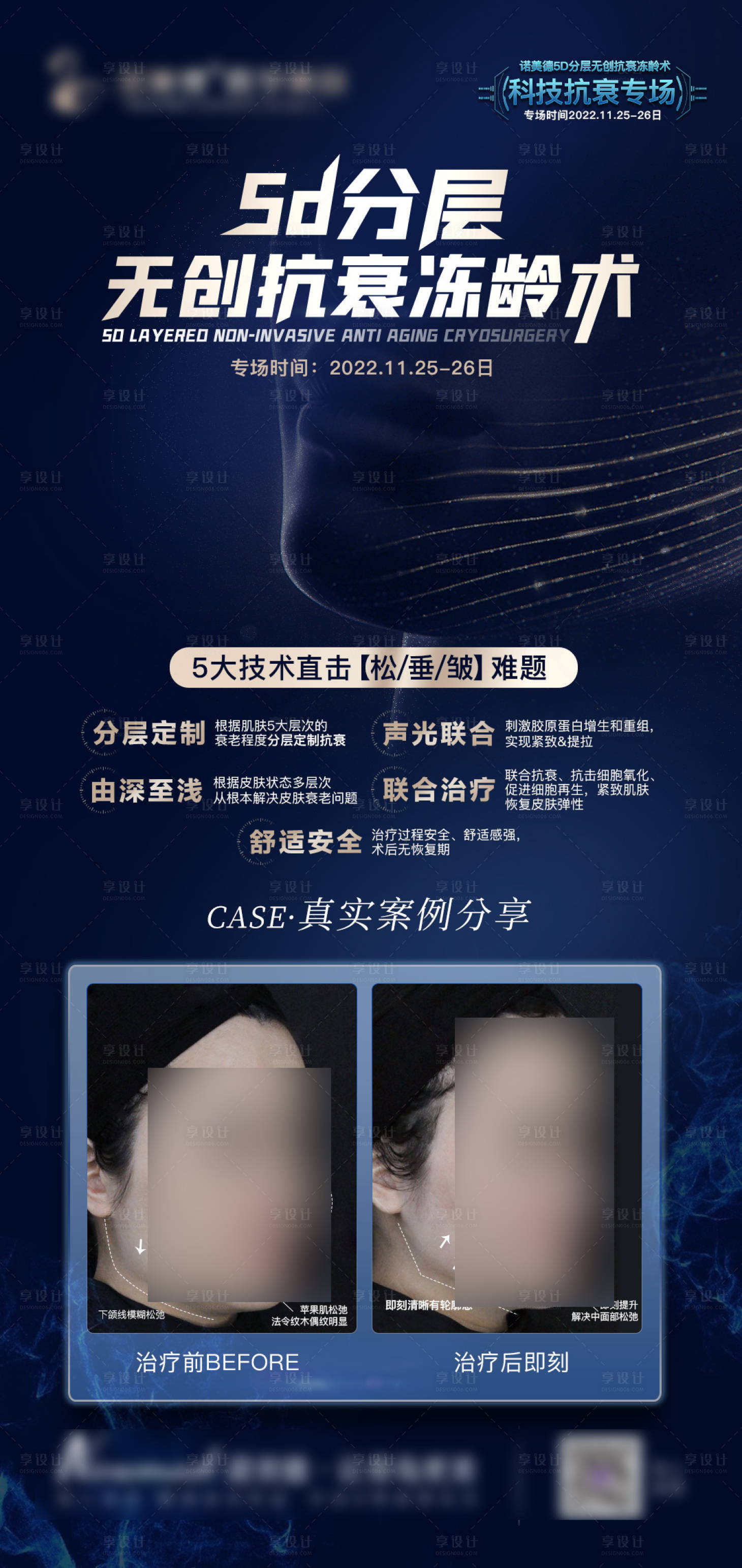 源文件下载【医美海报】编号：71070014062517989