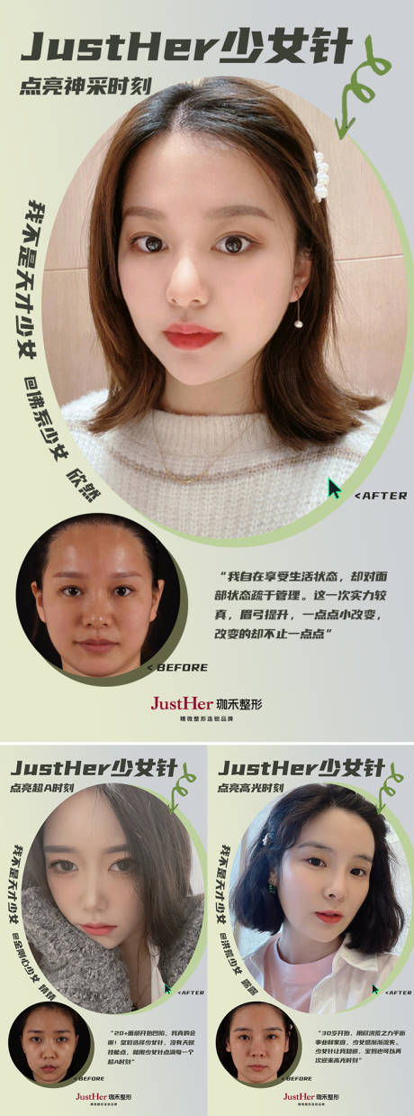 源文件下载【少女针案例】编号：33660013709413194