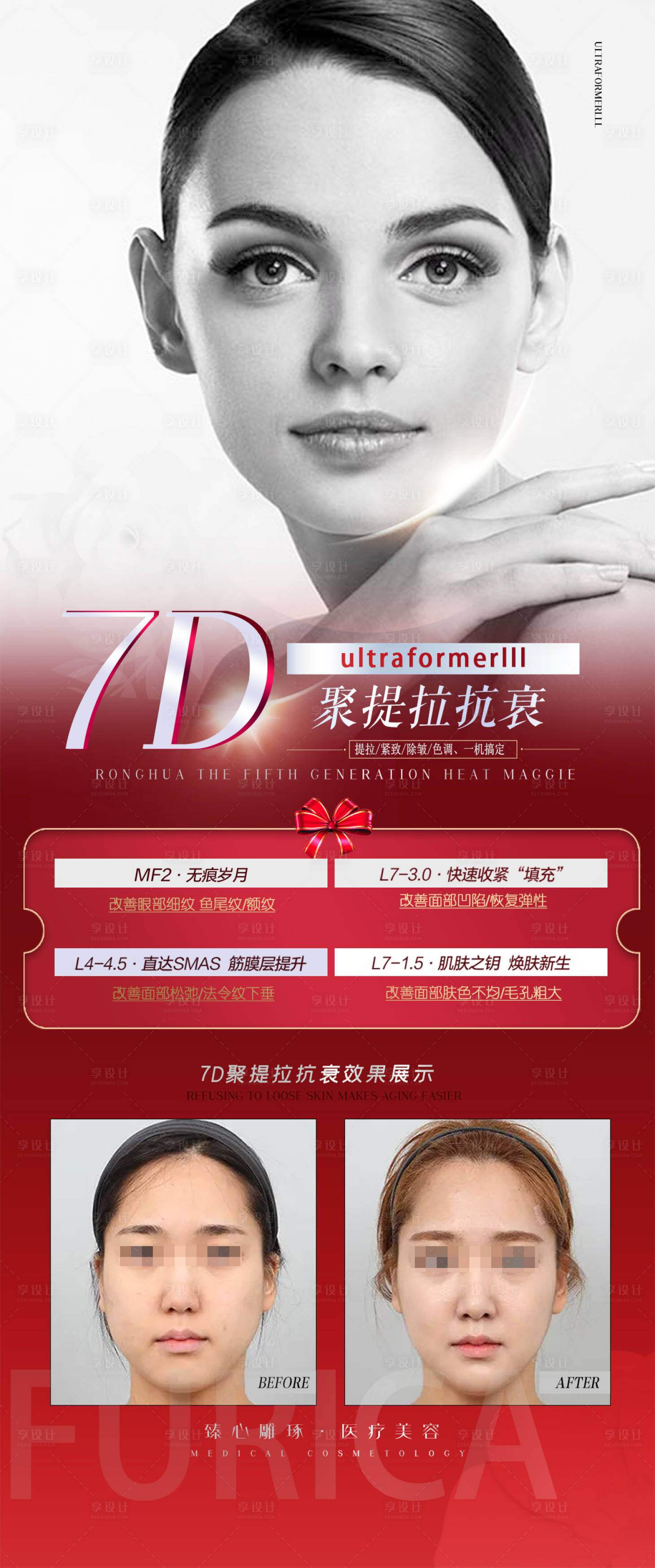 源文件下載【享設計】搜索編號：41500013952096658【醫美品項海報】