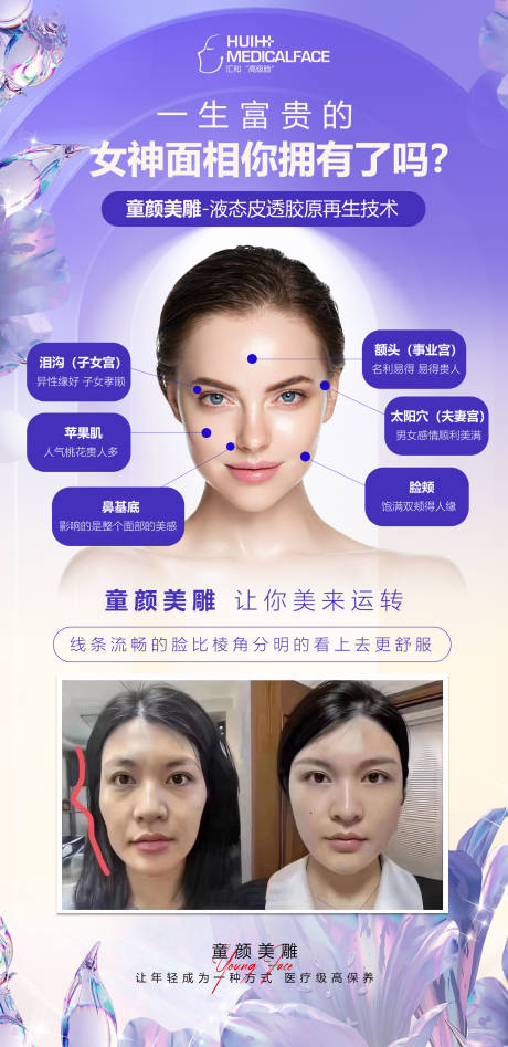 源文件下载【医美面部填充抗衰老】编号：71900014061784477