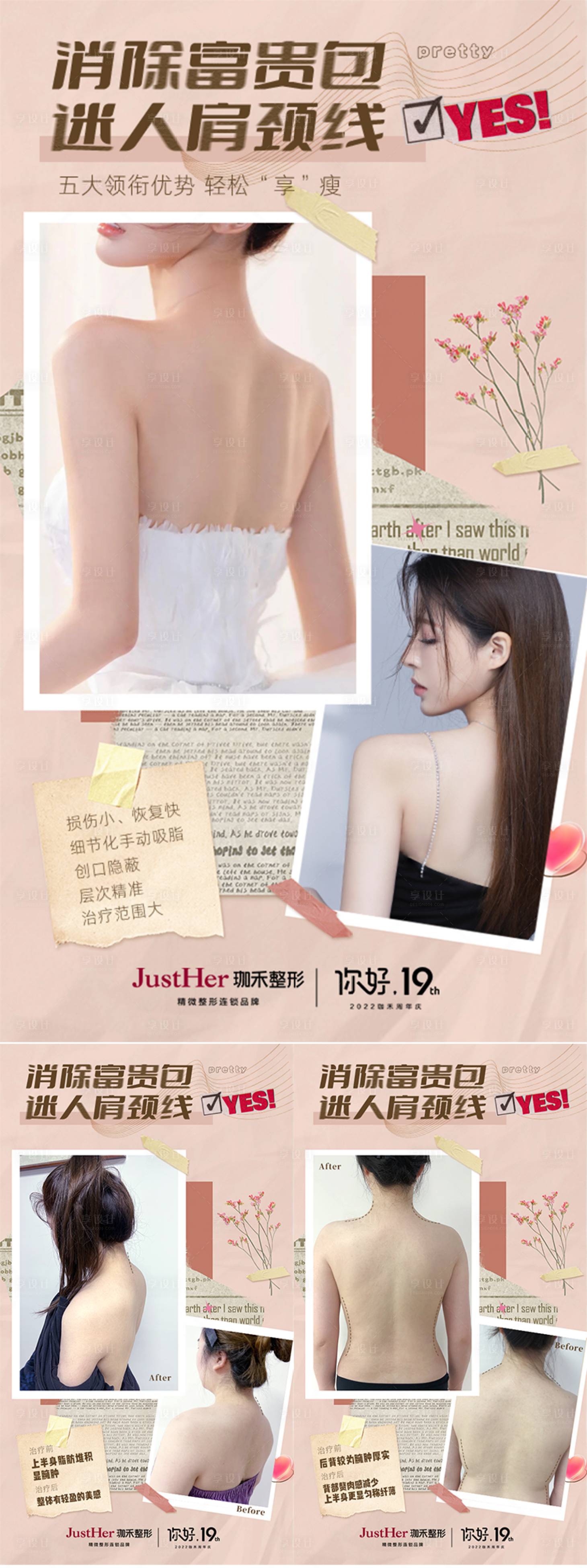 源文件下载【享设计】搜索编号：18330014217767712【吸脂案例海报 】