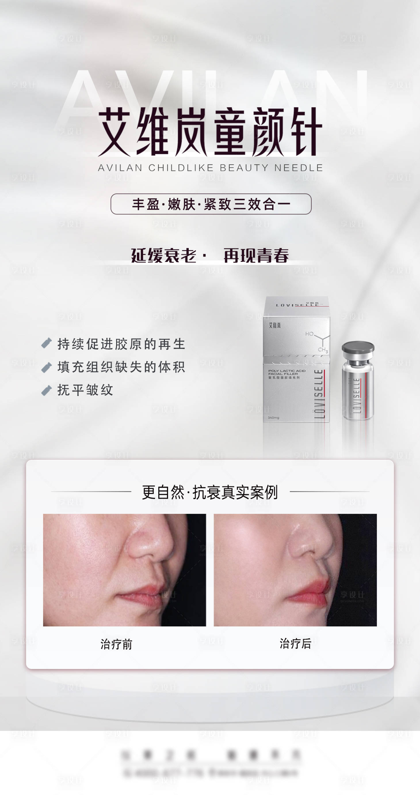 源文件下載【享設計】搜索編號：64170014180317242【艾維嵐童顏針】