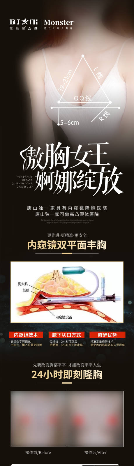 源文件下载【医美整形隆胸丰胸活动专场】编号：54670014207262657