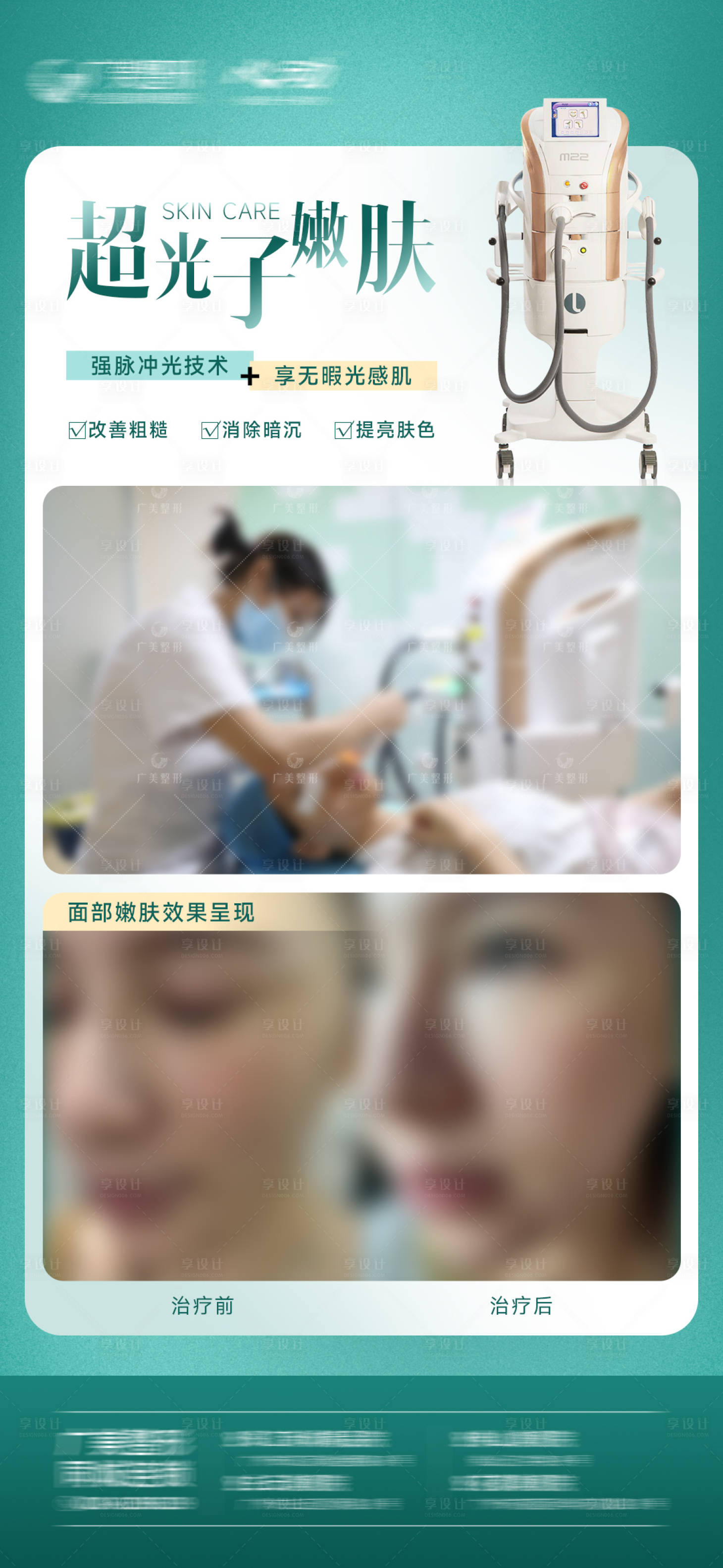 源文件下載【享設(shè)計(jì)】搜索編號(hào)：43690014220134423【超光子嫩膚案例朋友圈海報(bào)】