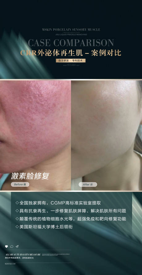 源文件下载【医美案例对比海报】编号：80430014112671037