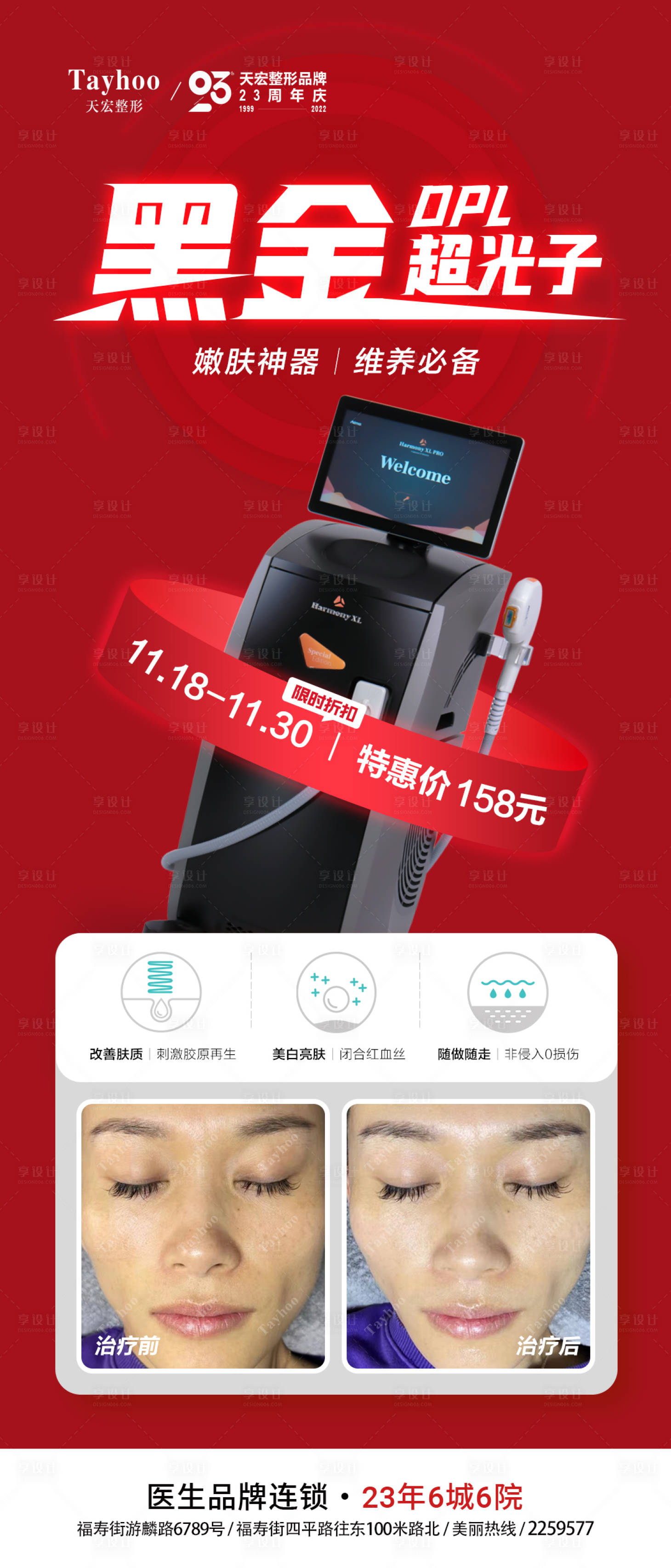 源文件下载【医美整形黑金超光子嫩肤祛斑海报】编号：17690014188859897