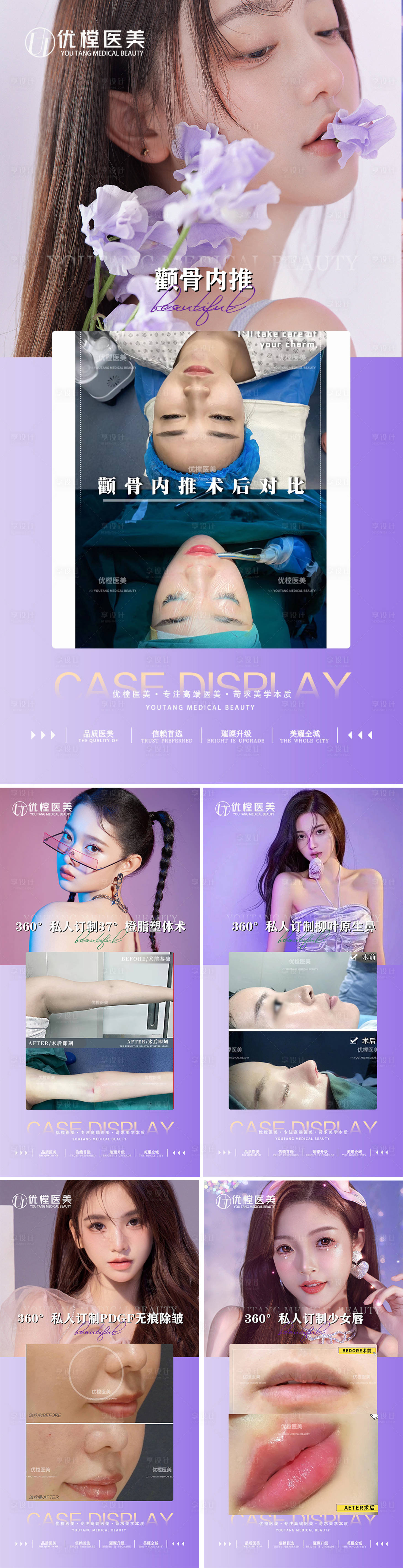 源文件下載【醫美案例對比海報】編號：63230014528895908