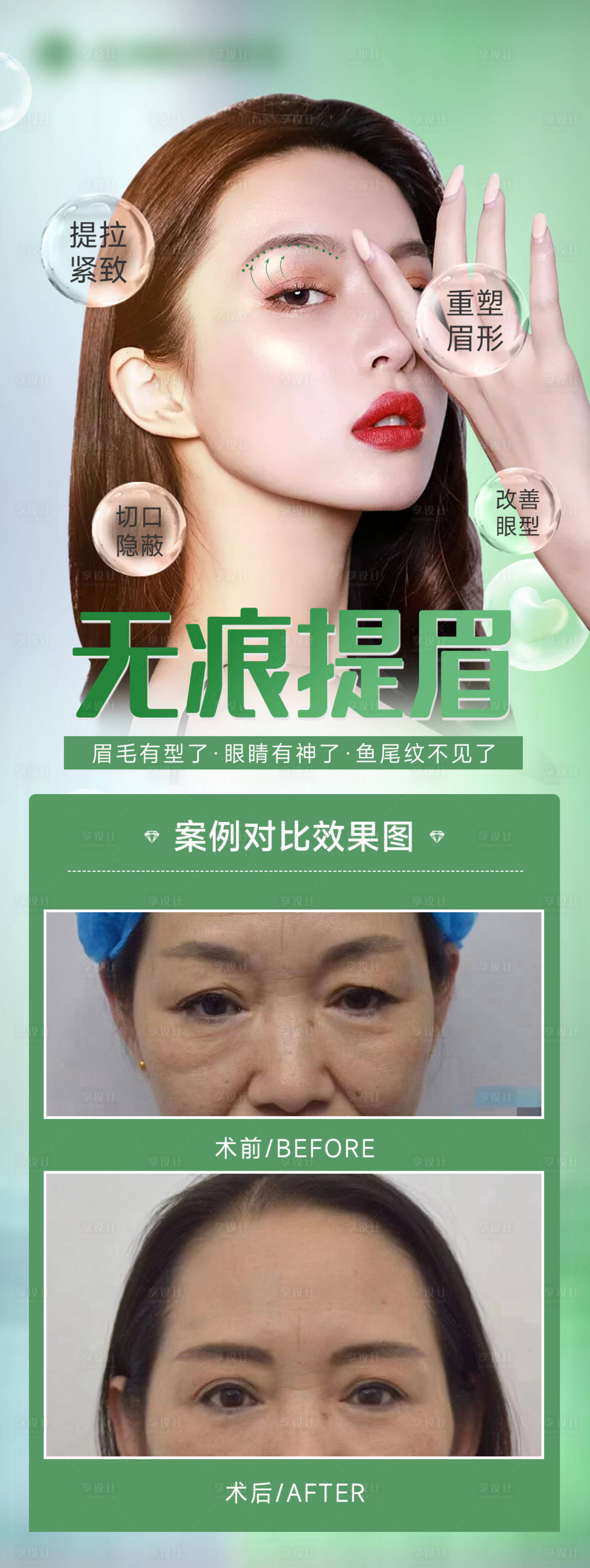 源文件下载【医美无痕提眉海报】编号：65820014561207834