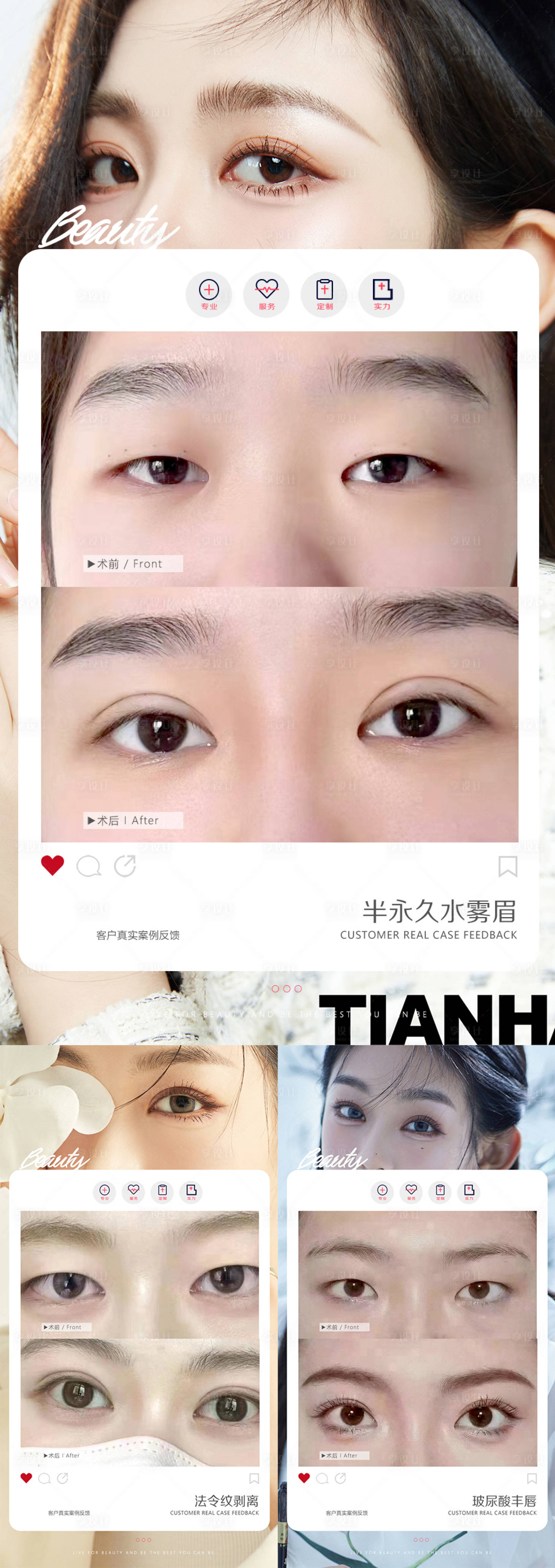 源文件下載【享設計】搜索編號：37170014914808801【醫美整形案例宣傳海報】