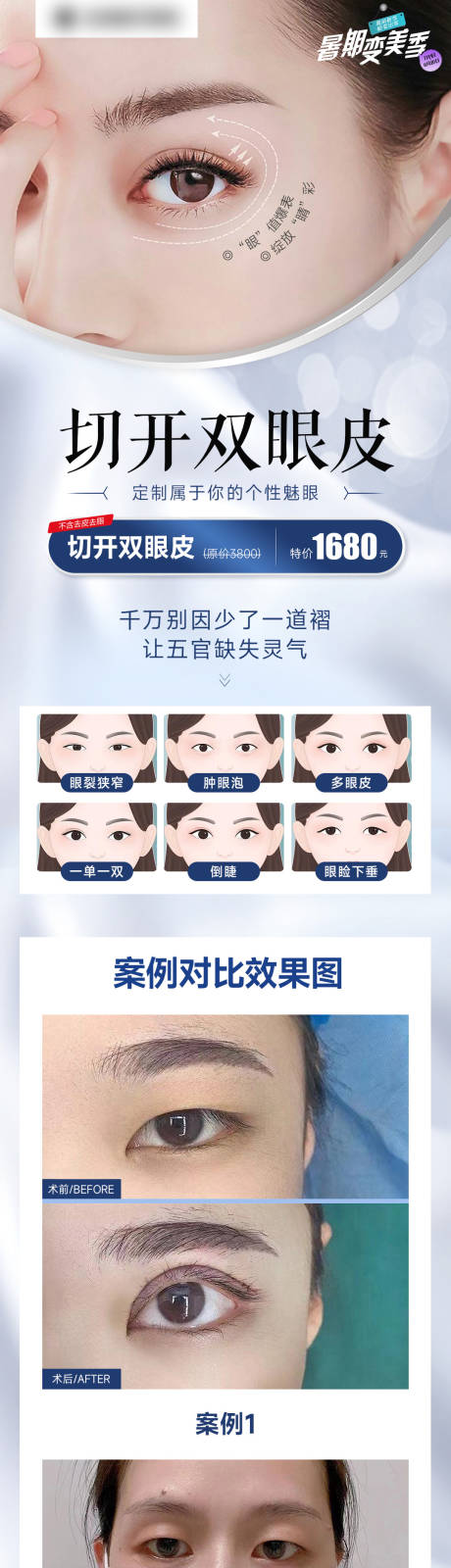 源文件下载【双眼皮案例长图】编号：70270014560676901