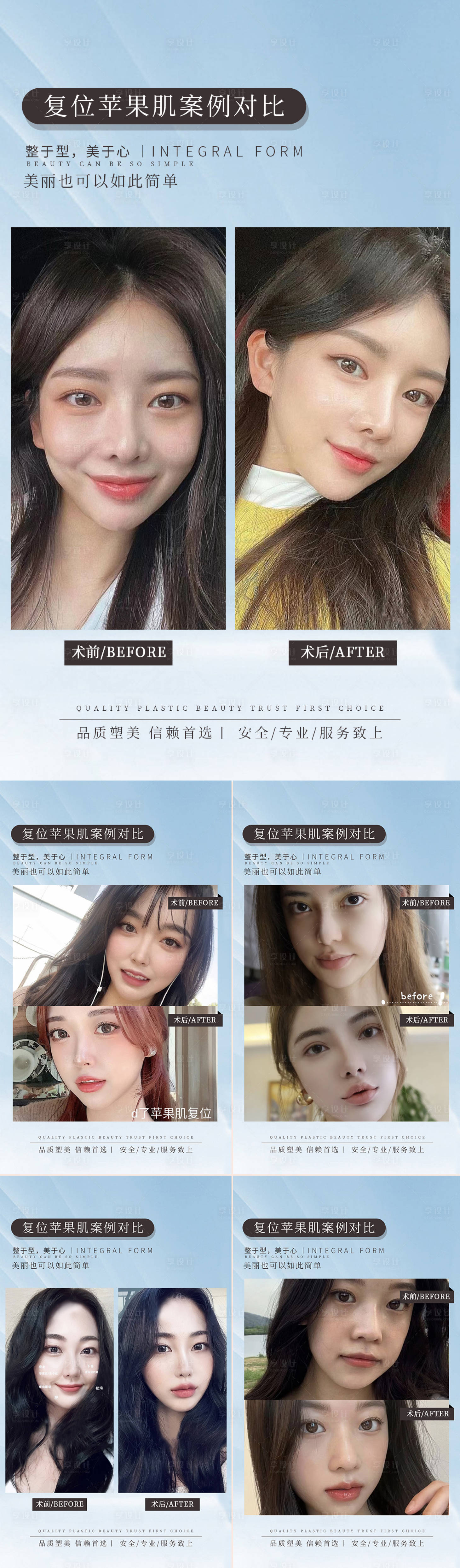 源文件下載【享設(shè)計(jì)】搜索編號：66430014552394214【醫(yī)美復(fù)蘋果肌案例對比海報(bào)】