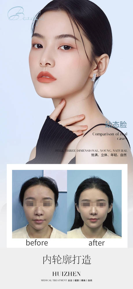 编号：20230217205630990【享设计】源文件下载-医美脸部轮廓案例海报