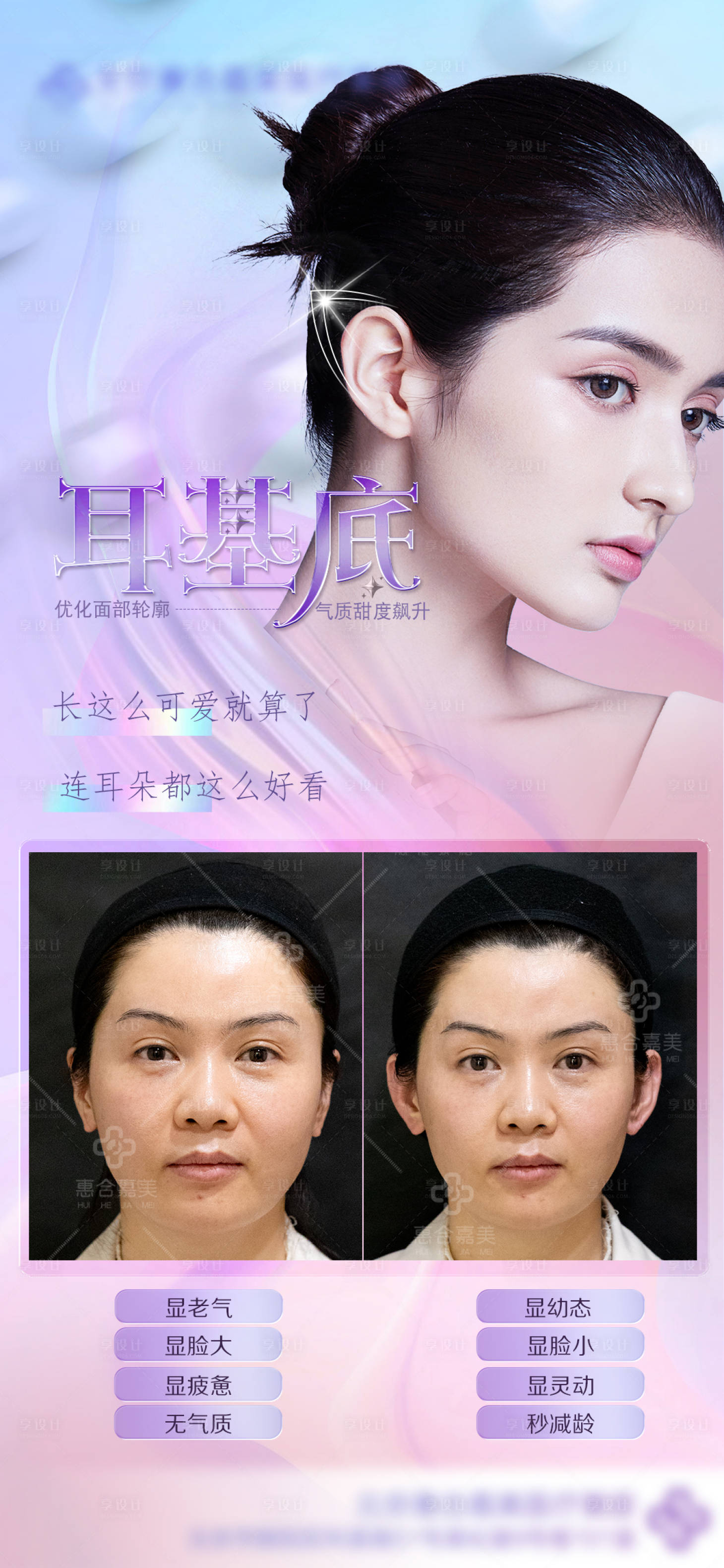 源文件下载【医美精灵耳海报】编号：38430014970733967