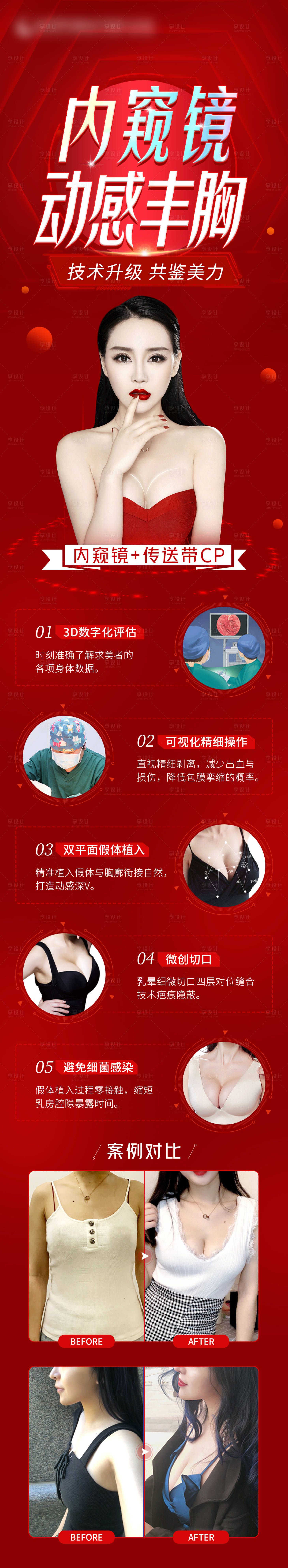 源文件下载【内窥镜动感丰胸长图海报】编号：53780014647985170